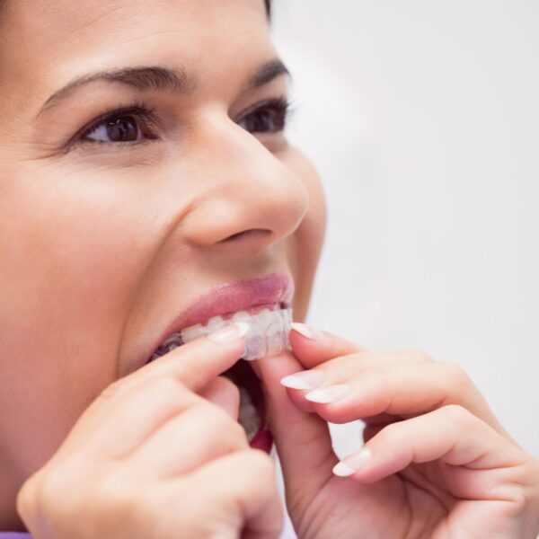 IN Zionsville Haven Dental Studio clear aligners orthodontic